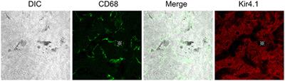 Tissue-Resident Macrophages in the Stria Vascularis